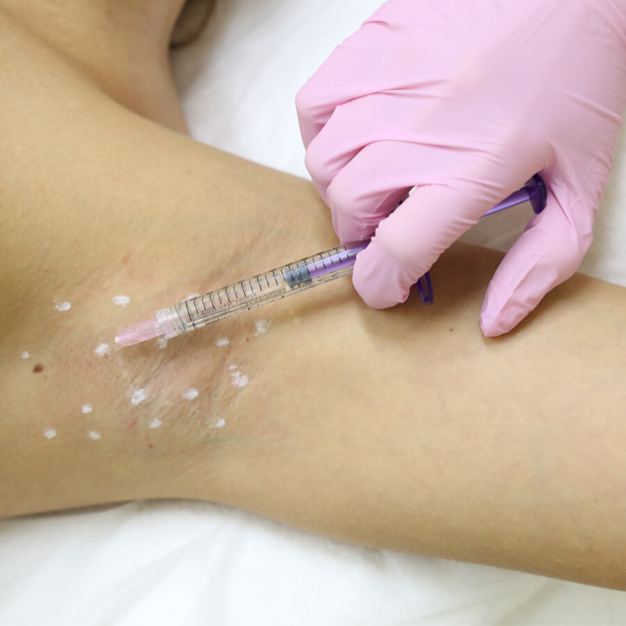 gipergidr.jpg